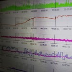 Demonstration psychophysiologischer Zusammenhänge mit einem Stresstest